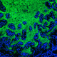 Gut bacteria, made fluorescent, in a mouse’s small intestine.